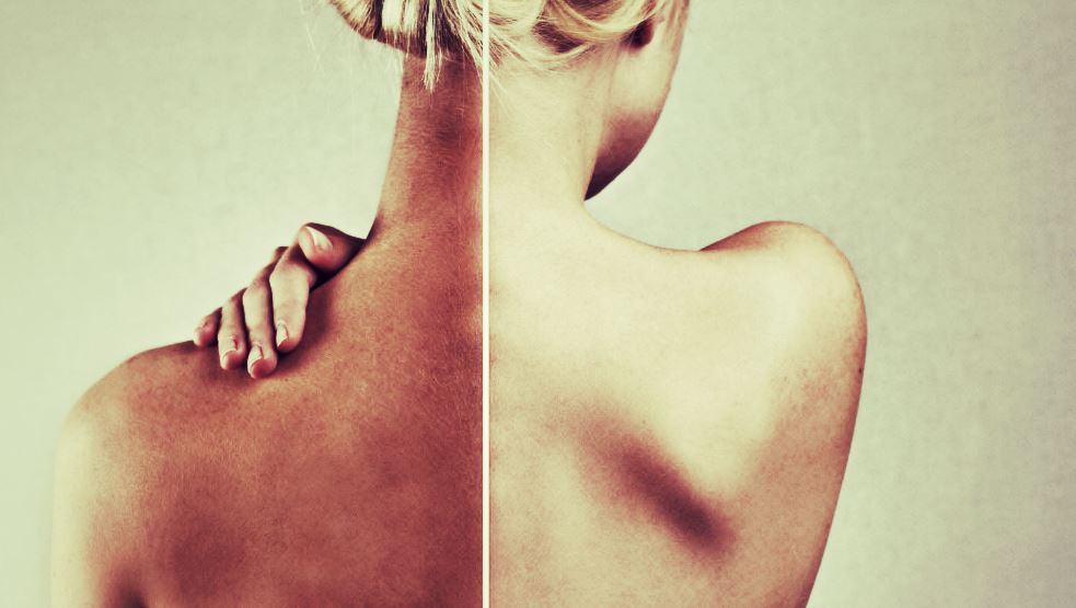 Prolonger naturellement son bronzage 