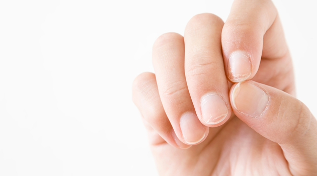 ongles abimés et cassants